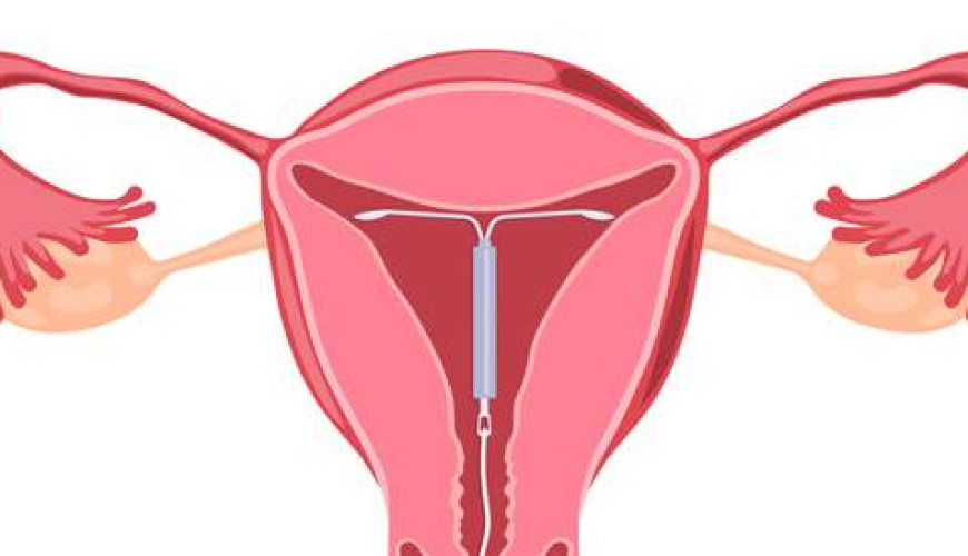 تركيب اللولب أثناء الولادة قد يصبح خطرًا.. كيف تستغل وزارة الصحة الموافقة المستنيرة؟